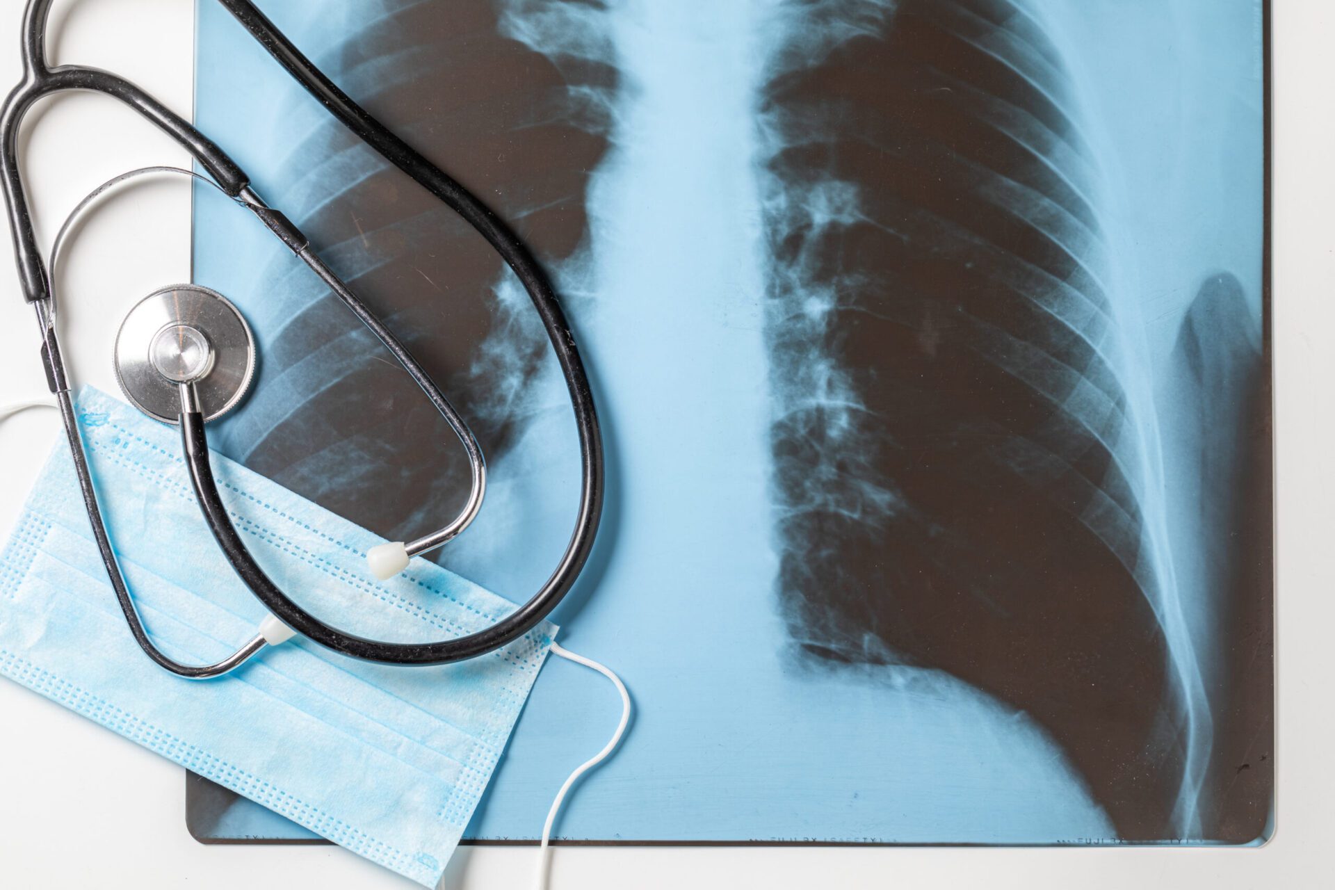 X-ray of sick lungs for coronavirus, mask and stethoscope Dr. Ramsey Joudeh, MD treatment on procressing